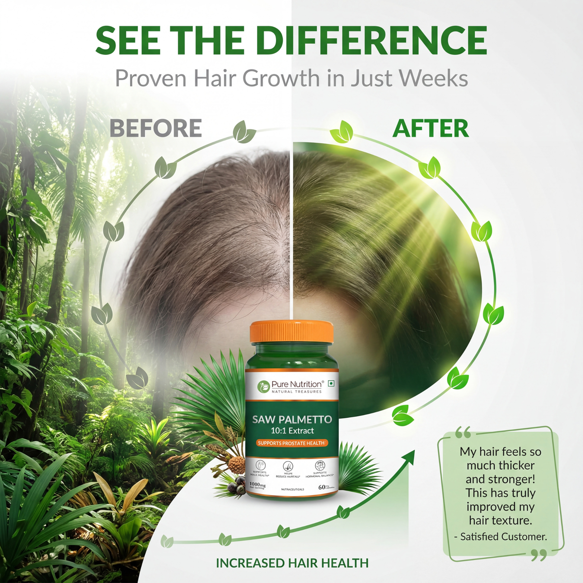 Saw Palmetto Supplement Prostate Health, Hair Growth & Urinary Support