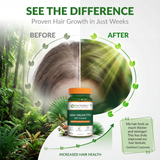 Saw Palmetto Supplement  Prostate Health, Hair Growth & Urinary Support